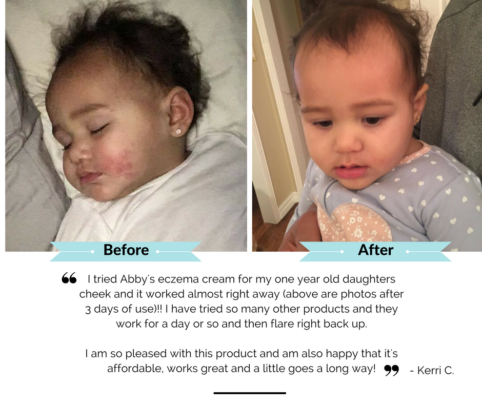 Conqueror Soothing Dry Skin Balm